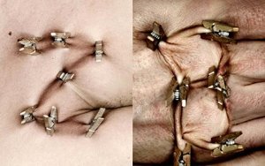 Foto Spieltriebe 32 Abfall Bergland Cäsar - Eine Menschensammlung von Werner Schwab